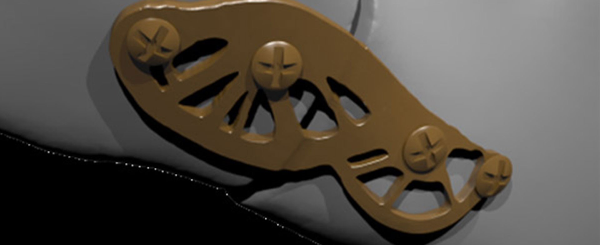 TOPOS – topologieoptimierte Osteosynthesen