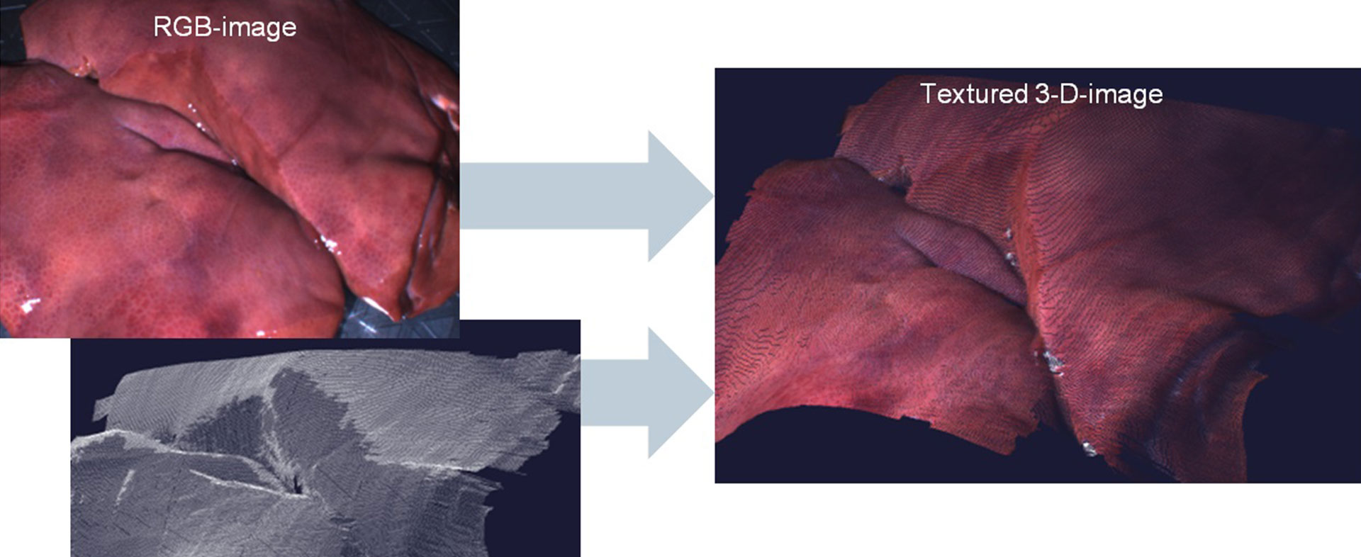 Workflow des „Textured 3D-Bildes“ aus Überlagerung von RGB Bild und 3D Point Cloud mit messtechnischer Tiefendarstellung [Quelle: Siemens AG, CT RTC SET]