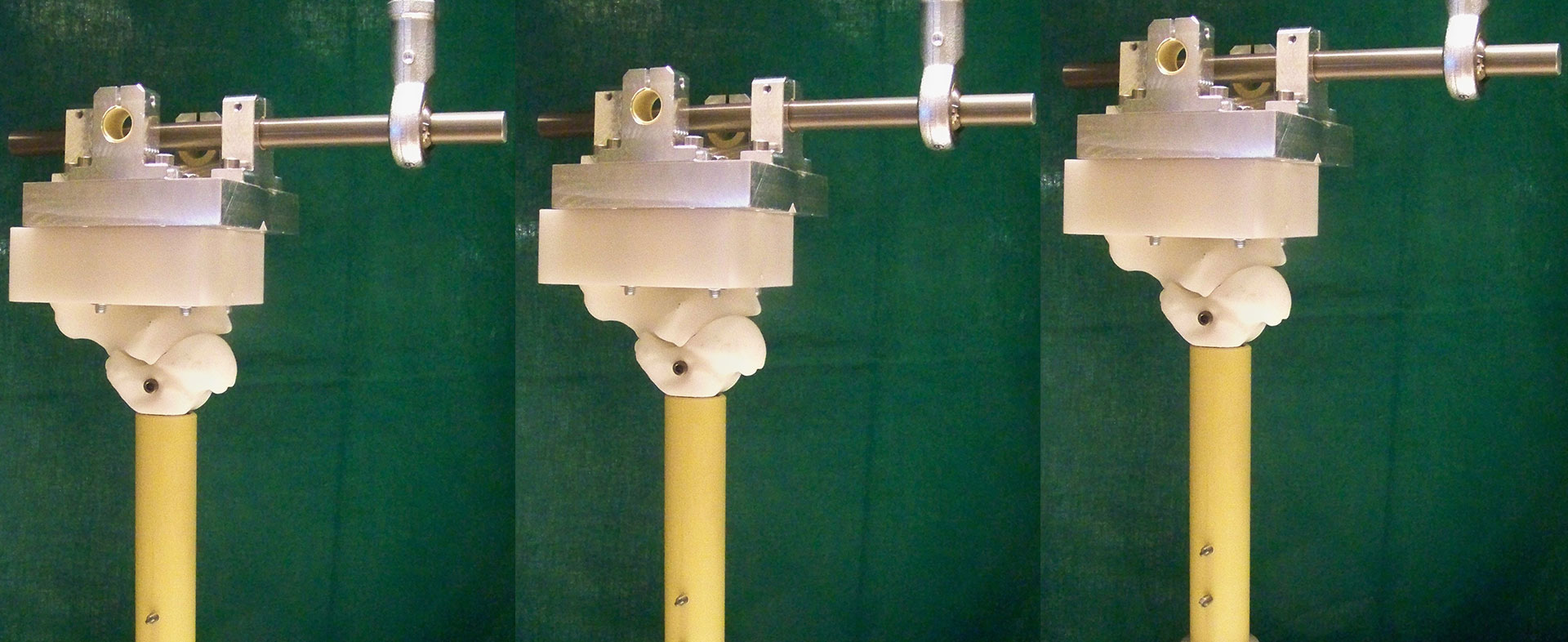 Erforschung eines Verblockungsmechanismus zur individuellen Behandlung von schwerwiegenden Deformitäten und Arthrose/Arthritis des Sprunggelenks