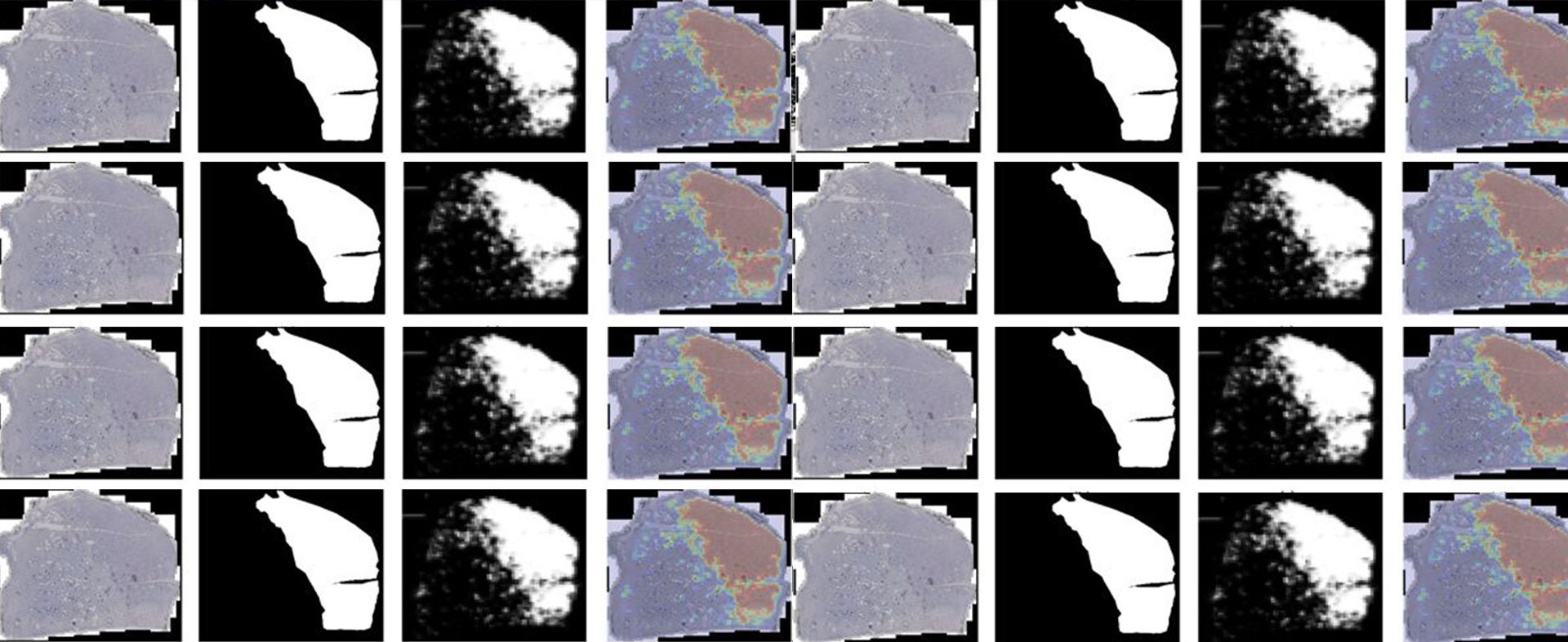 ImmunoProfiling mittels Neuronaler Netzwerke (IPN2)