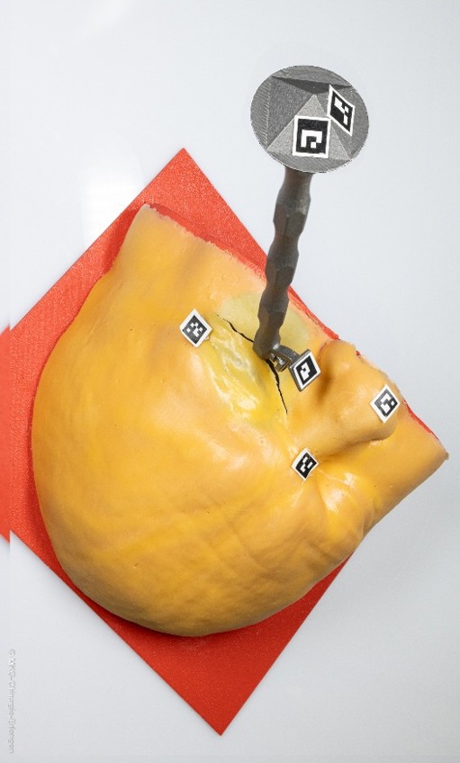 Darstellung des positionierten Implantats inkl. Markierung bei Erprobung am Modell (Quelle: Friedrich-Alexander-Universität Erlangen-Nürnberg, Lehrstuhl für Photonische Technologien)