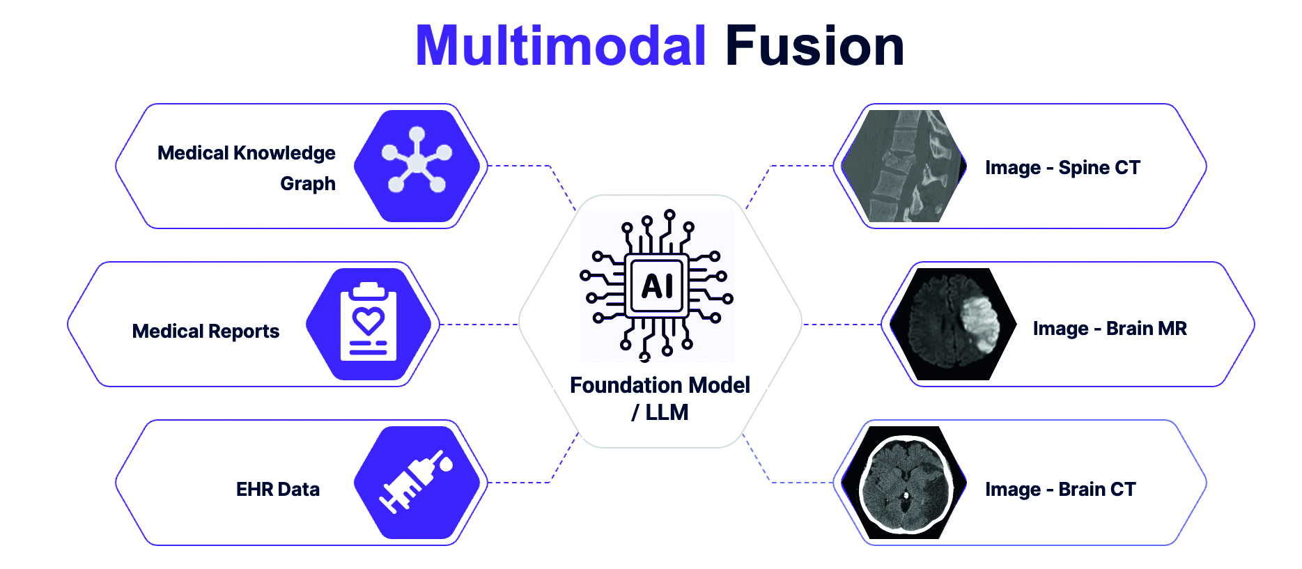 Multimodale Fusion im Projekt NeuroFUSE: Integration medizinischer Daten und Bilder zur Verbesserung der neuroradiologischen Diagnostik (Quelle: TUM, deepc GmbH, freepik.com, canva.com, radiopaedia.org)