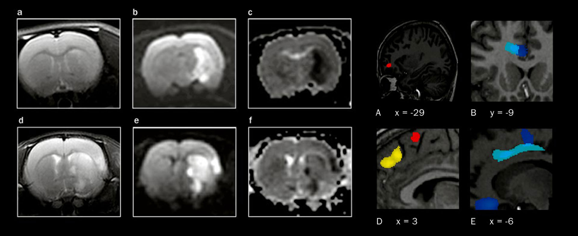 BayernBrain3T: 3-Tesla-Hochfeld-Magnetresonanz-Tomographie in Bayern