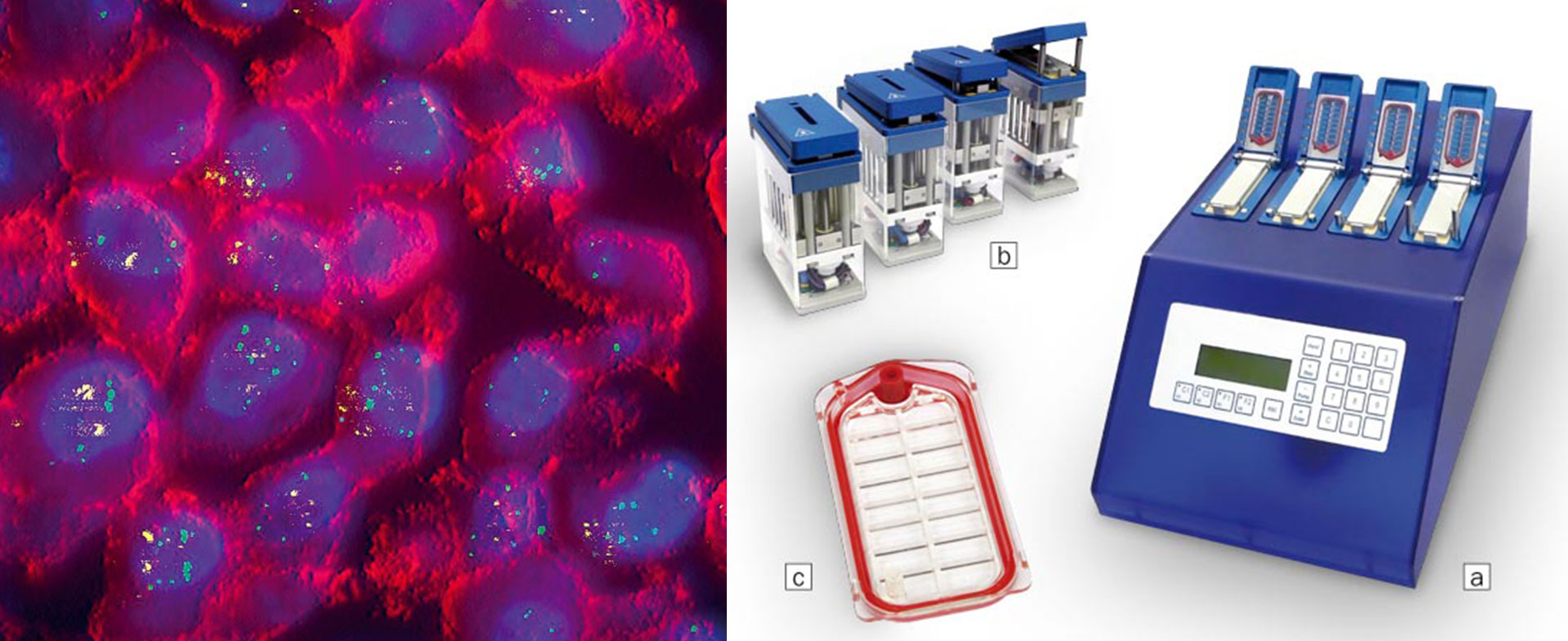 M-FISH: Multiplex Fluoreszenz-in-situ- Hybridisierung für die Krebs-Diagnostik
