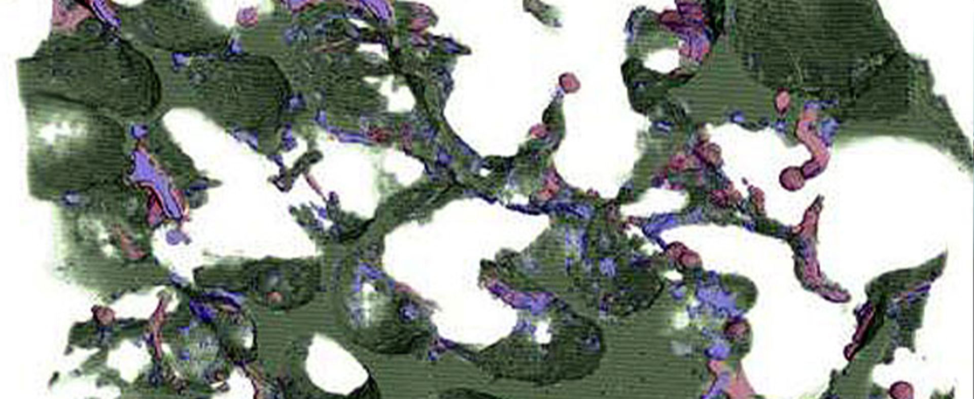 µ-FE und Sensitivitätsanalyse