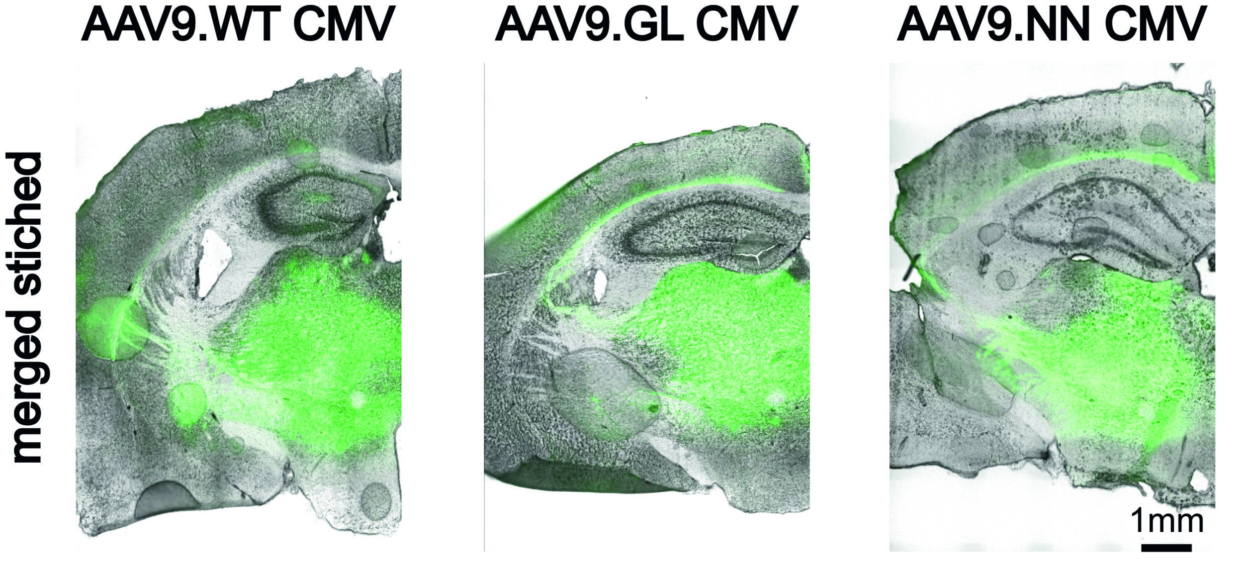 Enhanced-green-fluorescent-protein-Expression in thalamokortikalen Neuronen nach stereotaktischer rAAV9-Injektion bei sechs bis acht Wochen alten Mäusen. (Quelle: Dr. Verena Mehlfeld)